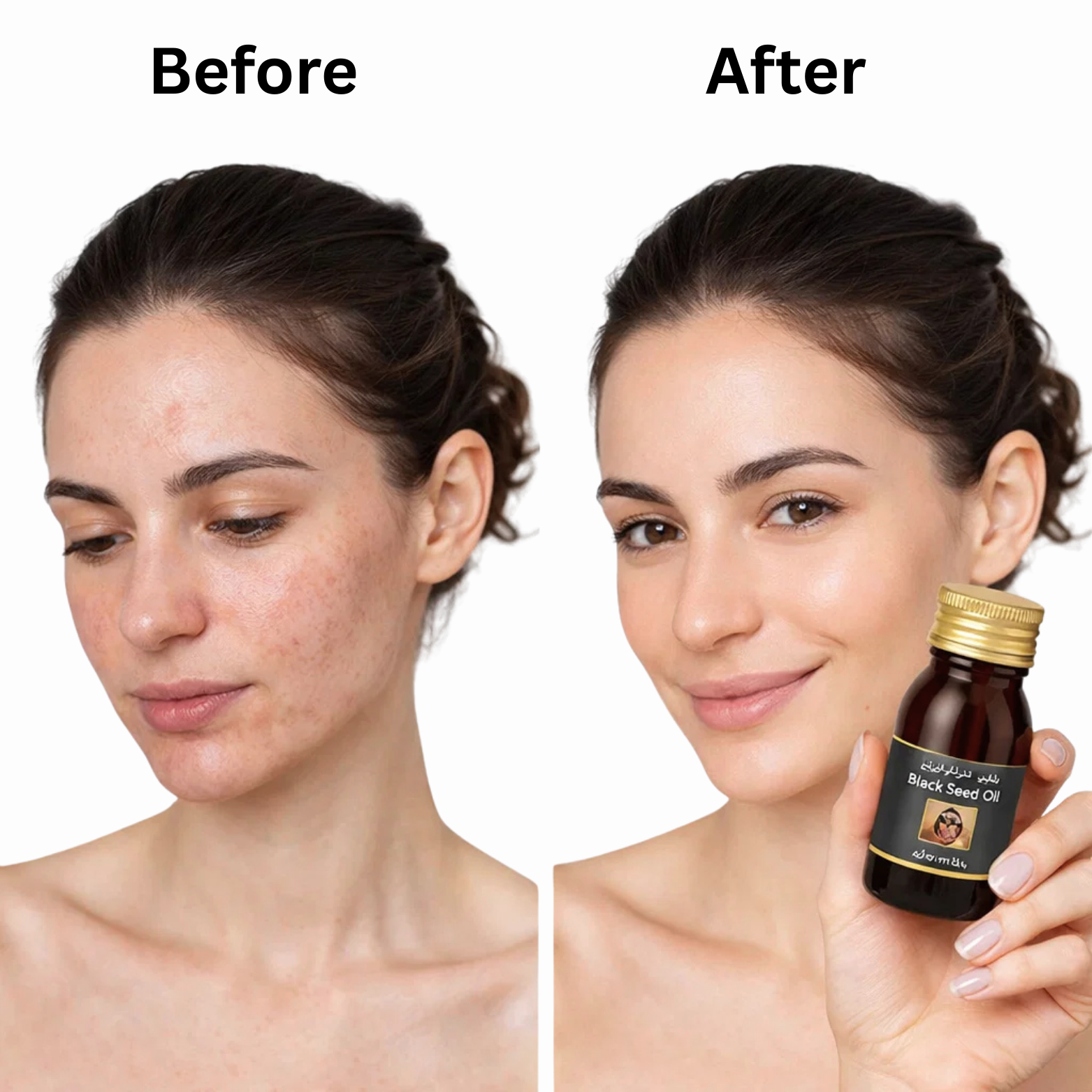 Black Cumin Seed Oil 30ml – Skin