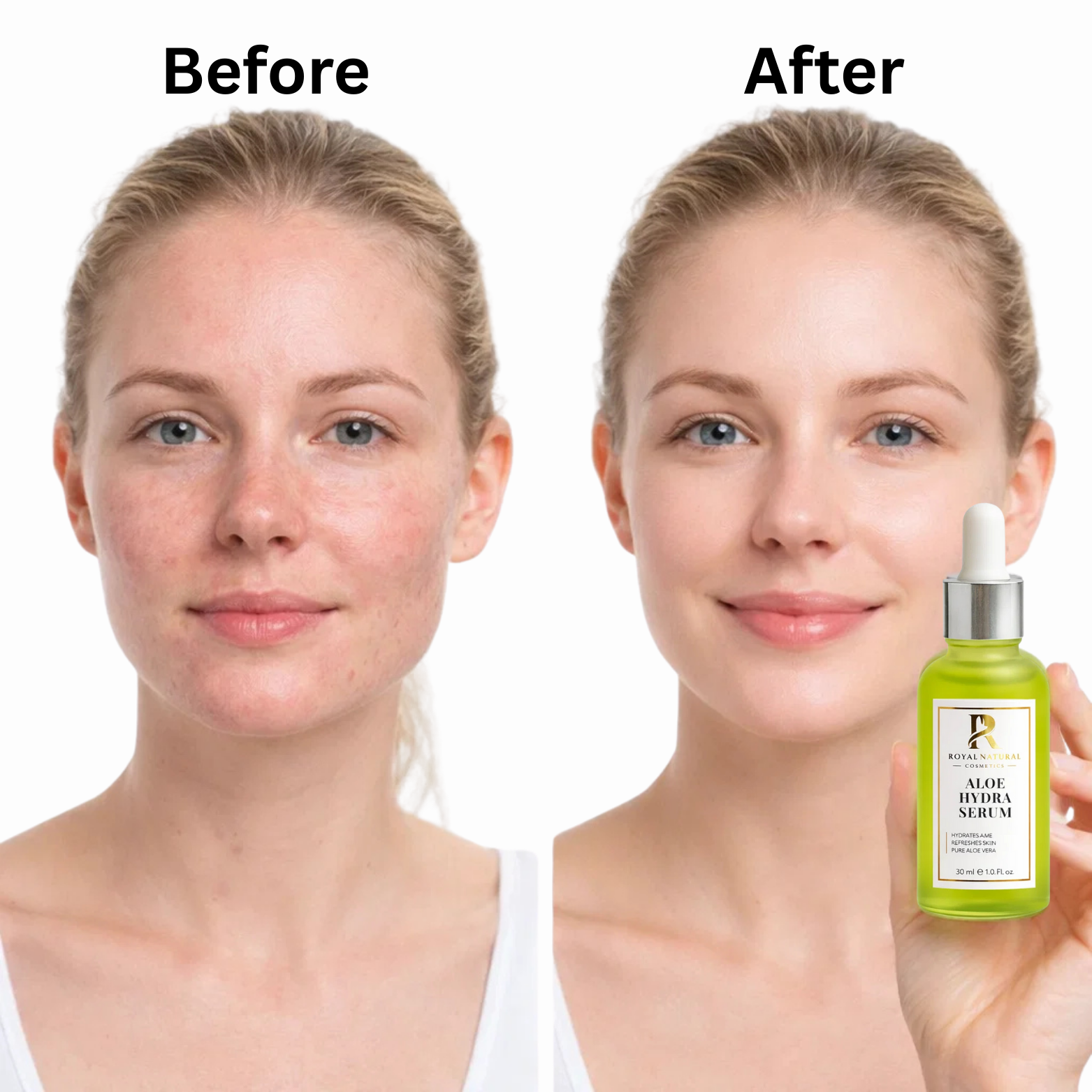 Aloë Vera Serum 30ml – Intens Hydraterend