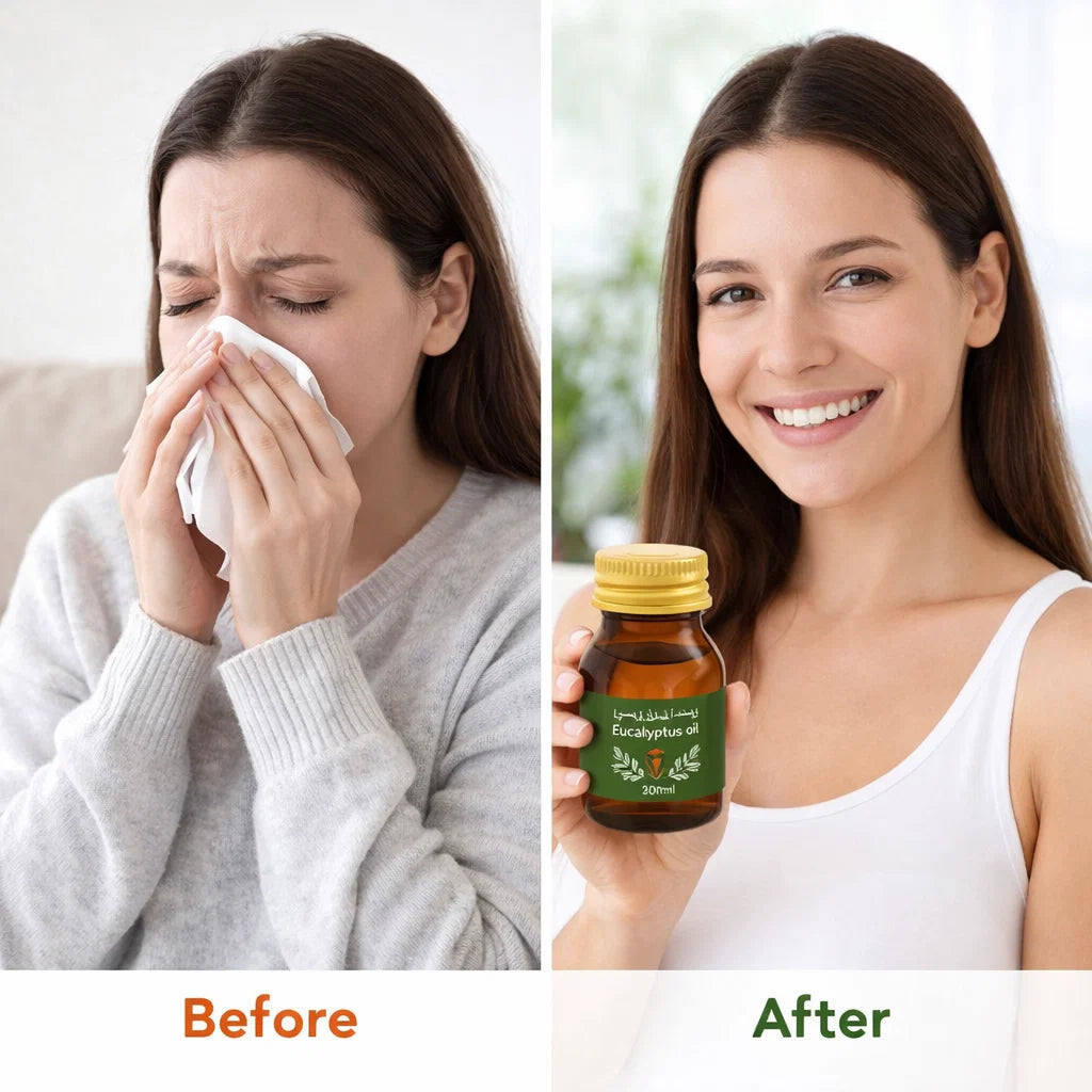 Eucalyptusolie 30ml – Verfrissend & Verlichtend